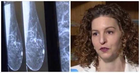 49 Year Old Breast Cancer Patient Grateful She Didnt Wait Until 50 For
