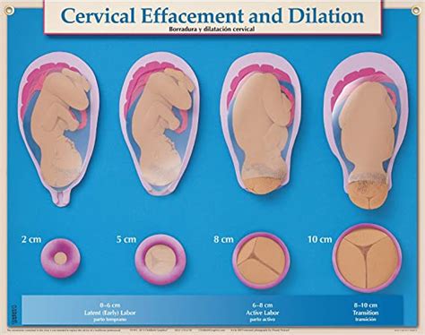 Technically it is the cervix that dilates in order to deliver the baby. 8 Cm Dilated Cervix