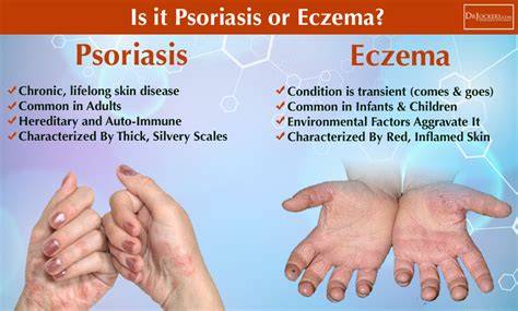 18 Ways To Beat Eczema Acne And Psoriasis Test 4 Acupuncture For