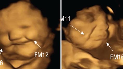 ultrasounds show fetuses smile for carrots but frown at kale inside edition