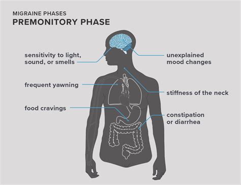 Ocular Migraine Symptoms Causes And Risks Ocular Migraine Migraine Prevention Ocular