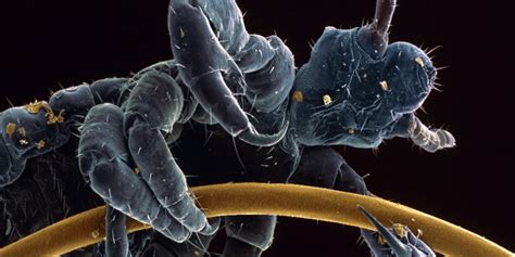 Lice Harbor Key Insights Into Human Evolution Scientists Say HuffPost