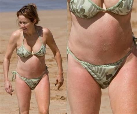 Patricia Heaton Plastic Surgery Photos Before After The Best Porn Website