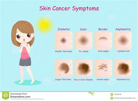 5 Signs Of Skin Cancer