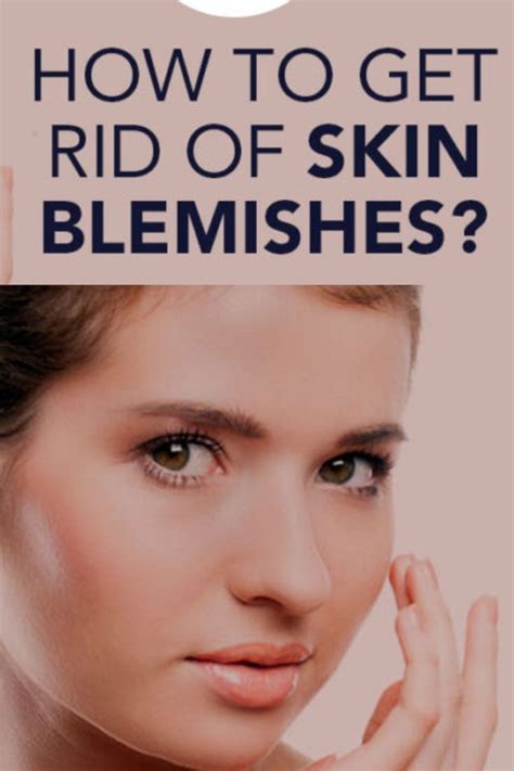 How To Get Rid Of Skin Blemishes In 2022 Skin Blemishes Skin Blemishes