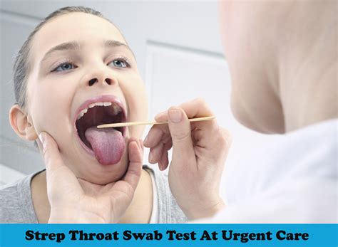 Strep Throat Cause Diagnosis Treatment Urgent Care