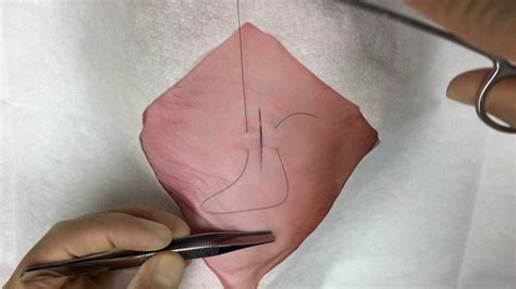 Further research examining the clinical outcomes of. The Inverting Horizontal Mattress Suture - YouTube