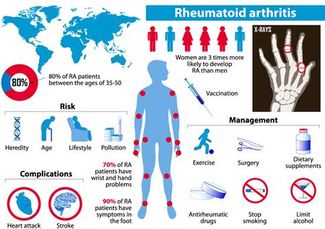 A Brief History Of Rheumatoid Arthritis Arthritis Research