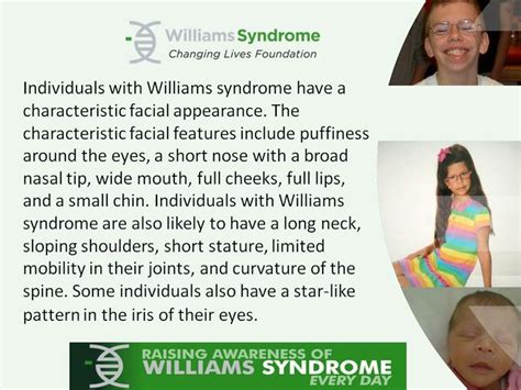 Wschanginglives Org Williams Syndrome Life Changes Fact Sheet
