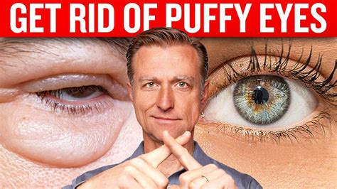 Get Rid Of Puffy Eyes For Good With Dr Berg S Proven Techniques Youtube
