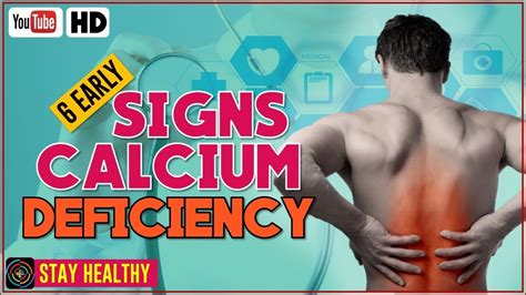 Signs And Dangers Of Calcium Deficiency Calcium Deficiency Symptoms