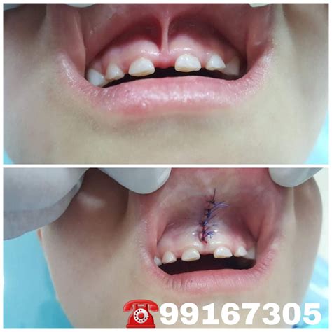 AMI Dental Clinic - Posts | Facebook