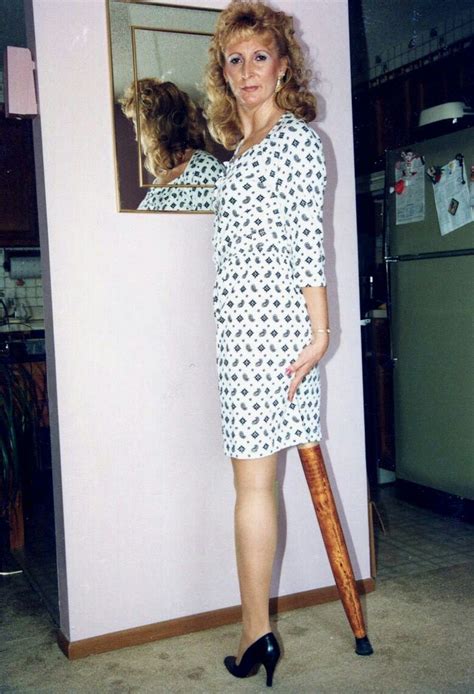 Nylons Prosthetic Leg Amputee Debbie Women Wear Dresses With