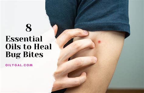 Top 8 Essential Oils To Heal Bug Bites And Prevent Them Too Oily Gal