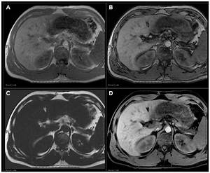 Full Text State Of The Art Cross Sectional Liver Imaging