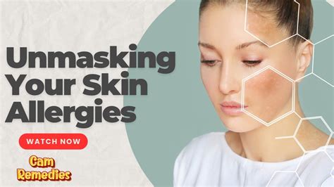 Unmasking Your Skin Allergies A Dermatologist S Guide To Ingredient Testings Youtube