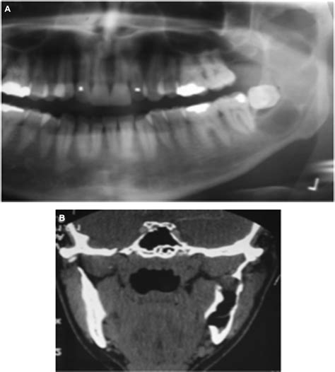 References in Topical 5-Fluorouracil is a Novel Targeted Therapy for