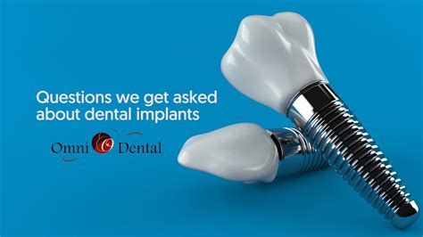 Questions About Dental Implants Answered Youtube