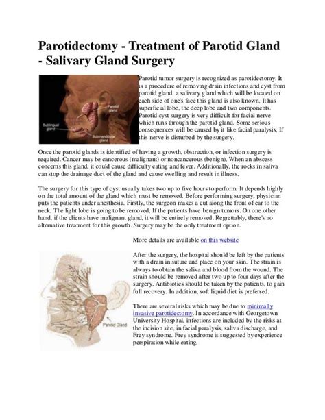 Parotid Salivary Gland Removal Superficial Parotidectomy