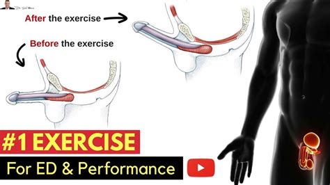 🤷🏼‍♂️ 1 Exercise For Preventing Erectile Dysfunction And Improving Your