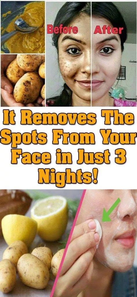 Remove Dark Spots On Your Face In Just 3 Nights Remove Dark Spots