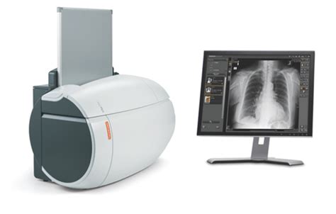 Computed Radiography CR System, Diagnostic Medical Imaging Equipment ...