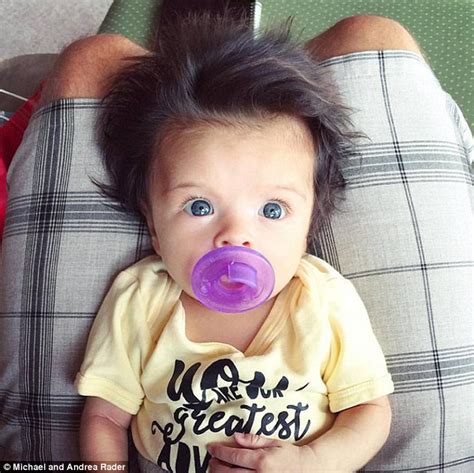 The bald spot at the back of your baby's head is most probably because your baby's head. Baby girl with voluminous hair becomes a viral sensation ...
