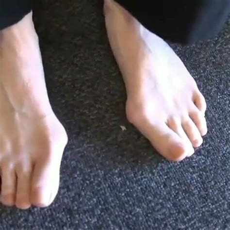 Very Beautiful Feet With Splendid Big Bunions Free Porn Xhamster