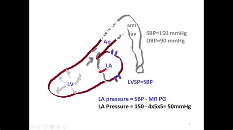 Answer To Question 7 How To Calculate Lvsp And La Pressure By Sbp And Mr