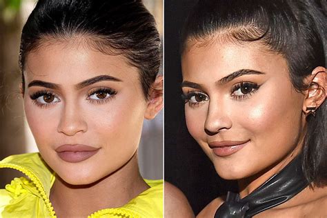 See Kylie Jenners Filler Free Lips