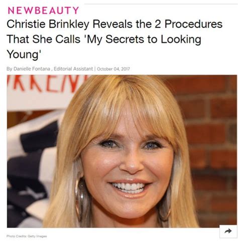 Christie Brinkleys Secrets To Looking Young Botox Ultherapy Xeomin
