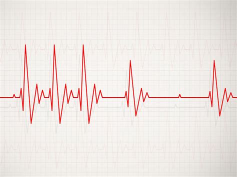 Zaburzenia Rytmu Serca Czym S Ich Objawy Oraz Przyczyny
