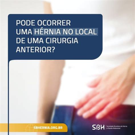 Pode Ocorrer Uma Hérnia No Local De Uma Cirurgia Anterior Sbh