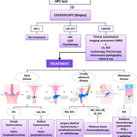 Algorithm For Screening And Treatment Of Cervical Cancer Cervical