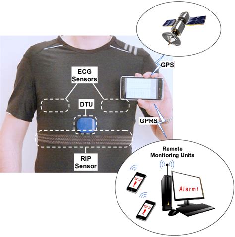 A Wireless Physiological Parameters Monitoring System Download