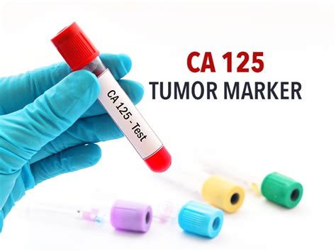 In some cases, a ca 125 test may be used to look for early signs of ovarian cancer in people with a very high risk of the disease. Does A Normal Ca125 Mean No Cancer - CancerWalls