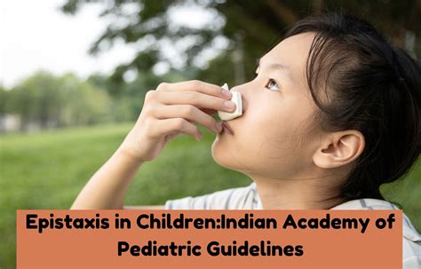 Epistaxis In Children Iap Guidelines