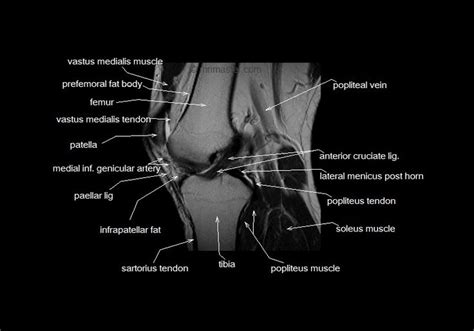 Mri Knee Anatomy Knee Sagittal Anatomy Free Cross Sectional Anatomy