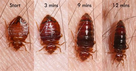 How long do bed bugs live? People that sleep around worry about STDs, but what they ...
