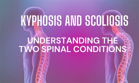Kyphosis And Scoliosis Treatment Options Dr Baker