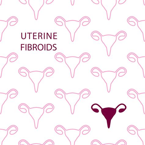 Fibroids And Fertility What Does That Mean Laurel Fertility Care