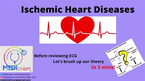 Ischemic Heart Diseasesihd Classification For Ecg Youtube