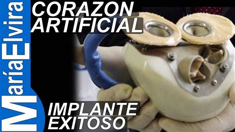 Primer Implante De Corazon Artificial Con Exito Youtube