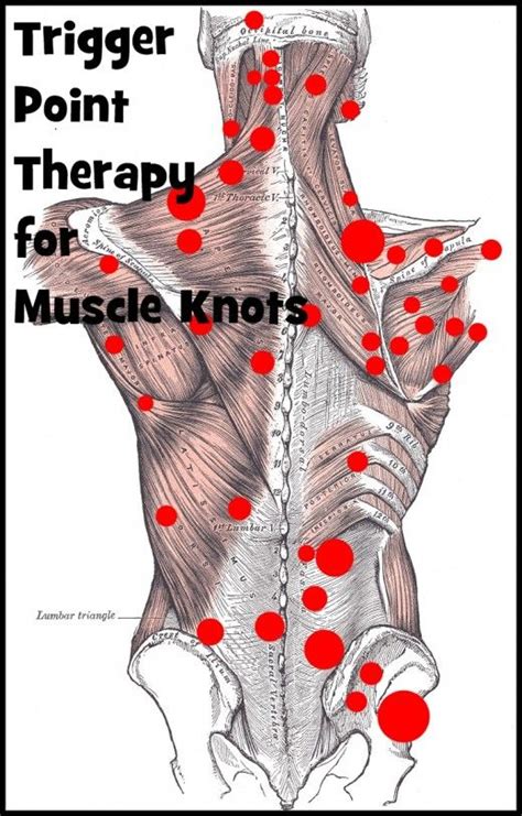 Effective Trigger Point Therapy For Muscle Knots Muscle Knots