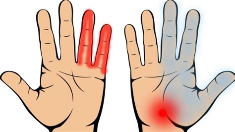 Ketika mengalami stroke ringan, bisa saja awalnya bagian tertentu dari tubuh misalnya tangan masih bisa digerakkan, namun lama kelamaan menjadi semakin. 7 Tanda Penyakit yang Boleh Kita Kesan Awal, hanya Dari ...