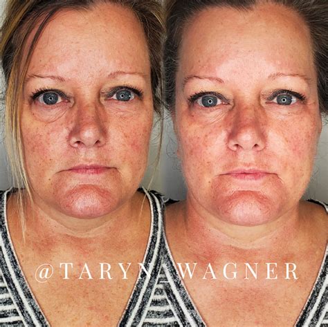 Cryoskin Facial Treatment Taryn Wagner Beauty Salon In Lodi Ca