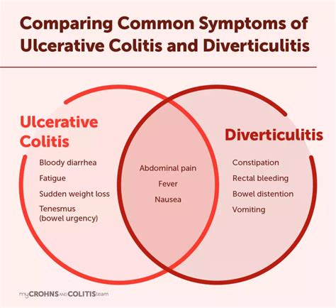 Diverticulitis Vs Ulcerative Colitis 5 Differences To Know