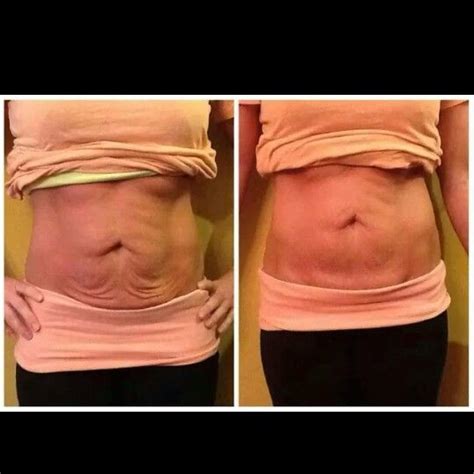 that crazy wrap thing get your amazing results today