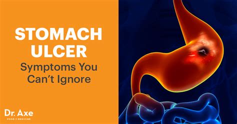 Jun 22, 2020 · the ketogenic diet, or keto diet, strictly limits carbohydrates while increasing the amount of fat that a person eats. Stomach Ulcer Symptoms & How to Treat Them - Dr. Axe