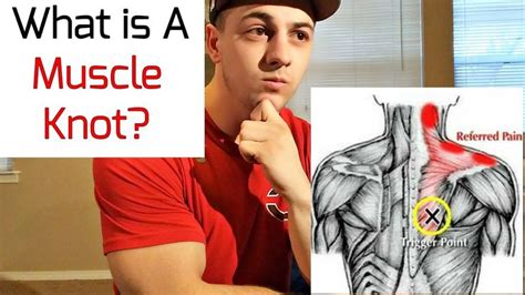 What Is A Muscle Knot Youtube Muscle Knots Muscle Massage Therapy